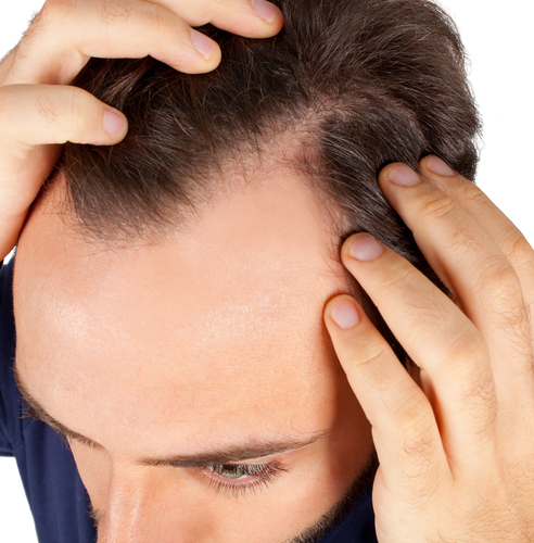 The Truth About Hair Transplantation - Frank Agullo, MD