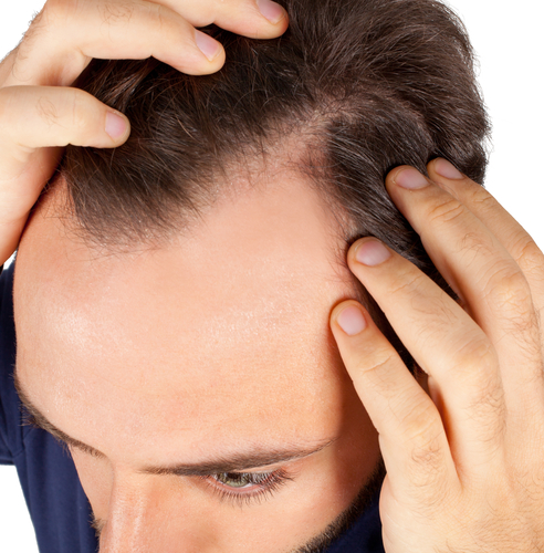 The Truth About Hair Transplantation