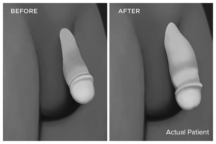 before and after digital demonstration