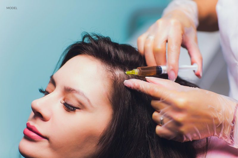 Young woman undergoing a PRP injection in her scalp for hair restoration.