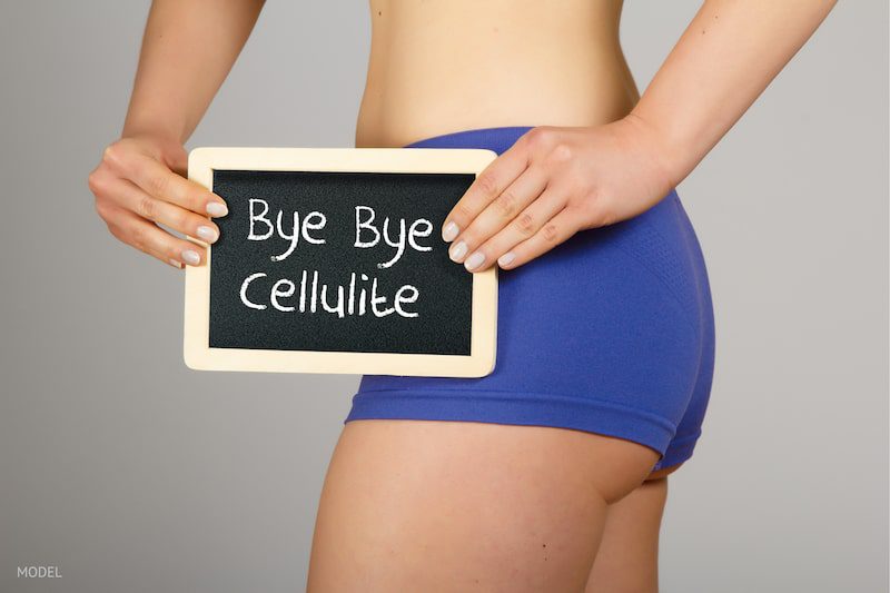 Thin woman in blue underwear holding a sign that says bye bye cellulite.