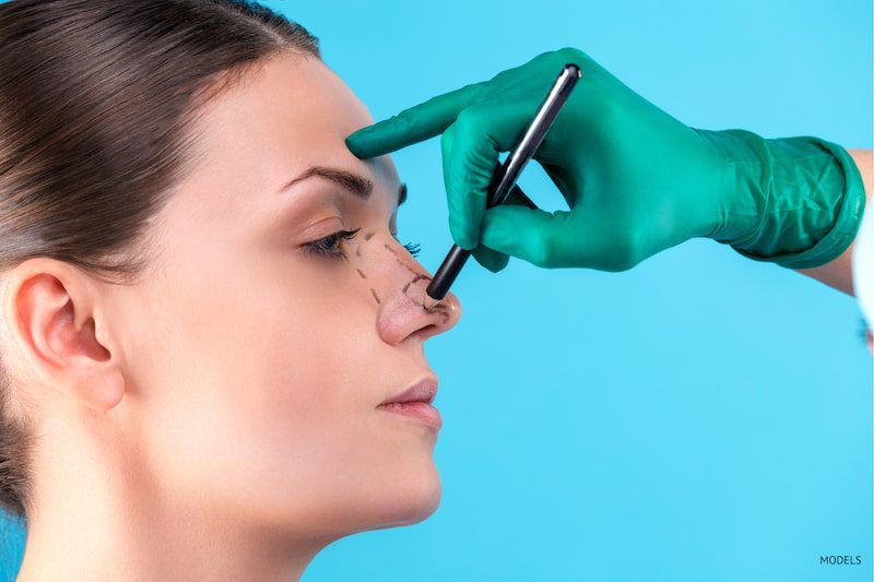 Woman getting prepped for her rhinoplasty surgeon by her surgeon.