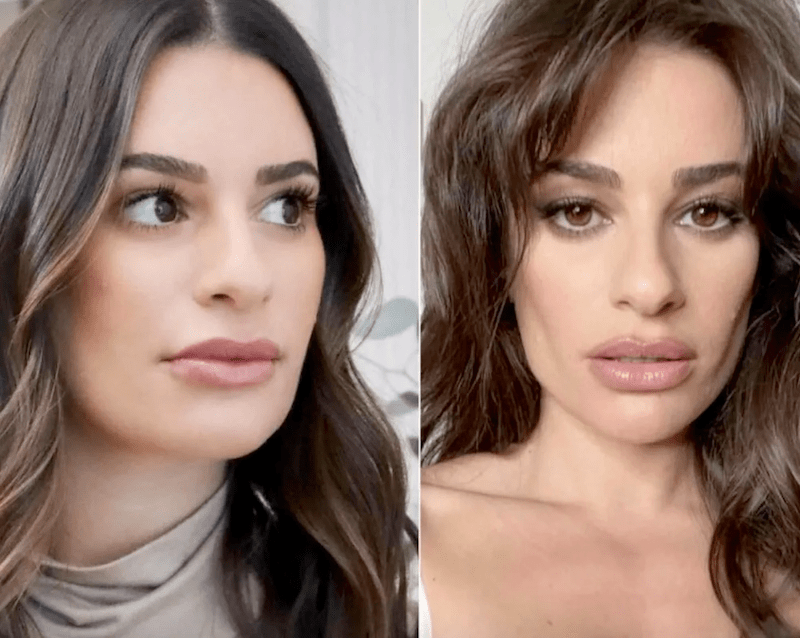 Before and after of Lea Michele showing a possible facial procedure.