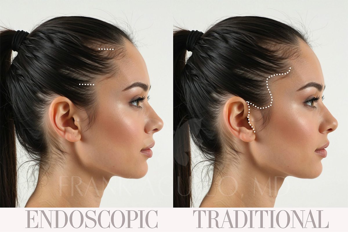 Before and after results 2