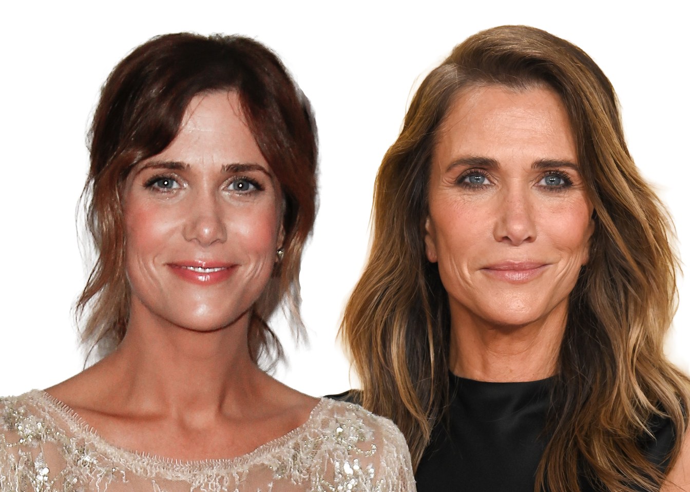 What a Facelift Changes and What It Does Not: Reading the Kristen Wiig Photos
