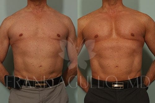 Body Before and After 2